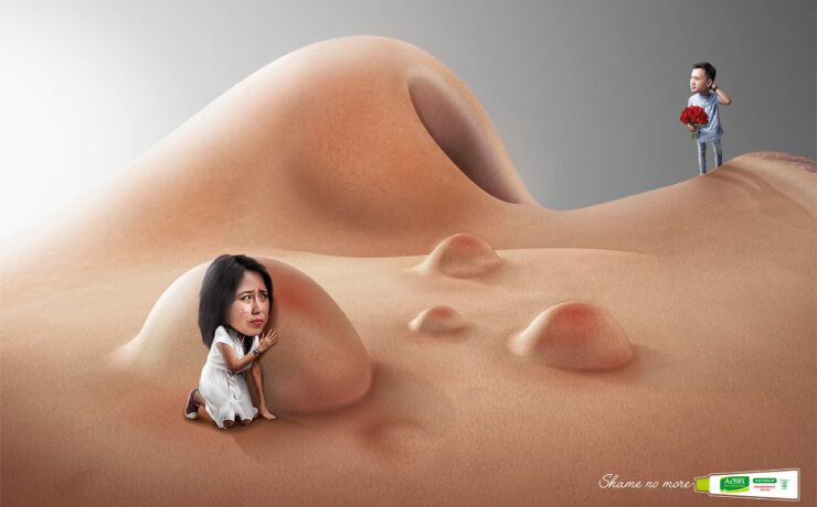 Mentholatum Shame no more 1 cotw