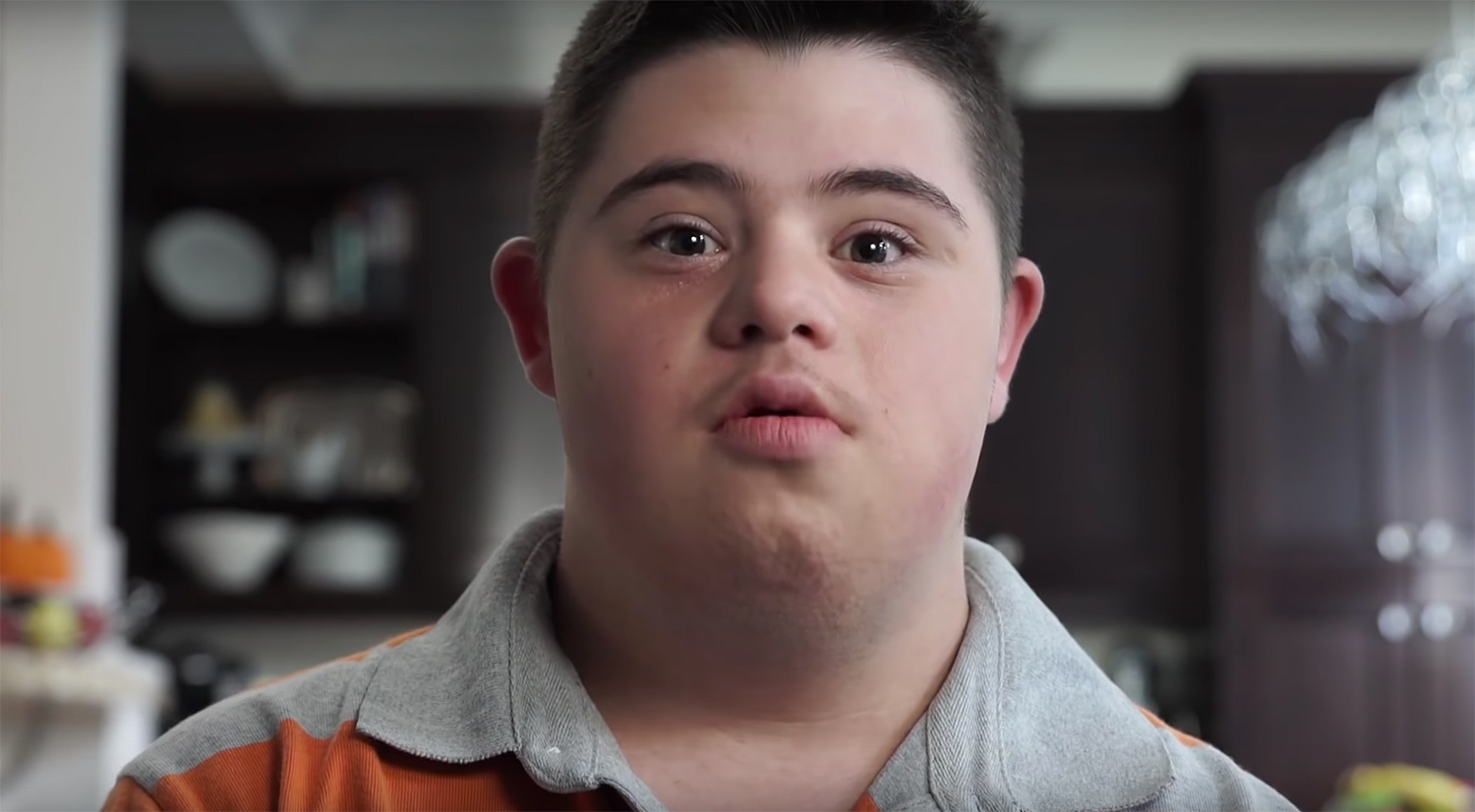 Canadian campaign gets creative on the Down Syndrome