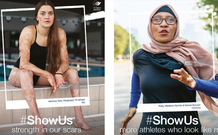 Project #ShowUs